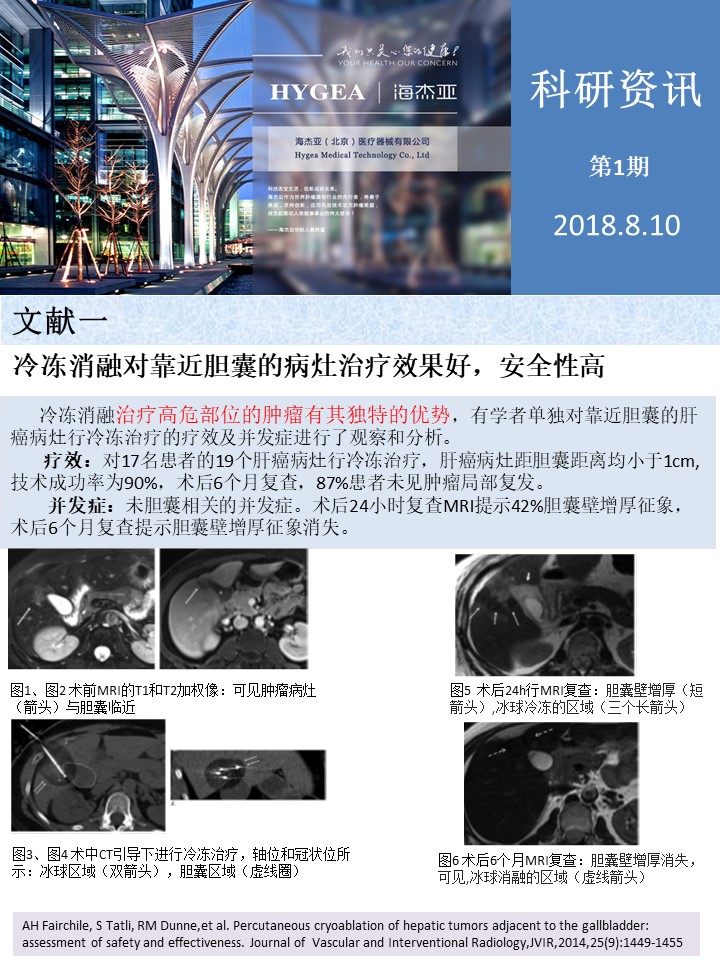 【海杰亞科研資訊】第1期——肝、肺癌消融